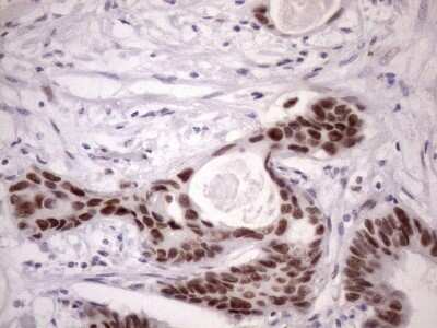 Immunohistochemistry: SFRS9 Antibody (OTI5G7) - Azide and BSA Free [NBP2-74152]