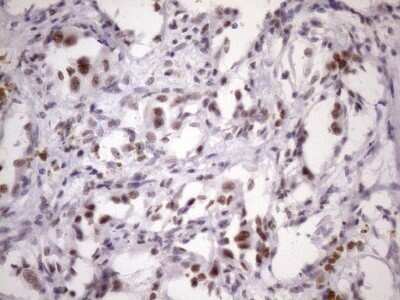 Immunohistochemistry: SFRS9 Antibody (OTI5G7) - Azide and BSA Free [NBP2-74152]