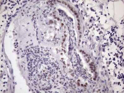 Immunohistochemistry: SFRS9 Antibody (OTI5G7) - Azide and BSA Free [NBP2-74152]