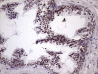 Immunohistochemistry: SFRS9 Antibody (OTI5G7) - Azide and BSA Free [NBP2-74152]