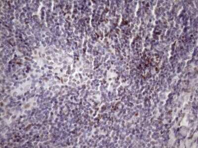 Immunohistochemistry: SFRS9 Antibody (OTI5G7) - Azide and BSA Free [NBP2-74152]