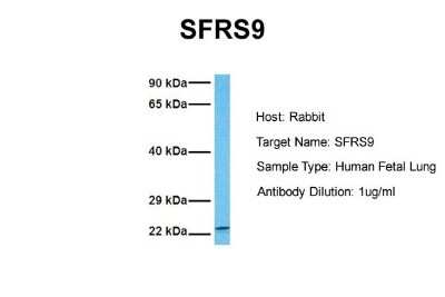 Western Blot: SFRS9 Antibody [NBP1-57465]