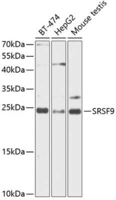 Western Blot: SFRS9 AntibodyBSA Free [NBP2-95128]