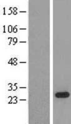 Western Blot: SFRS9 Overexpression Lysate [NBL1-15893]