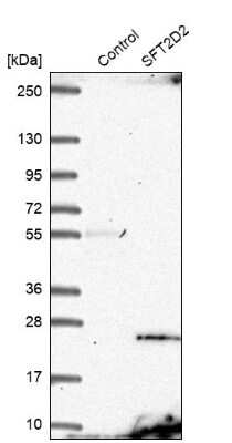 Western Blot: SFT2B Antibody [NBP1-88013]