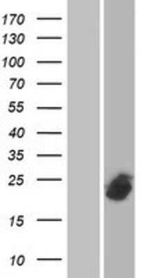 Western Blot: SFT2D3 Overexpression Lysate [NBP2-05973]