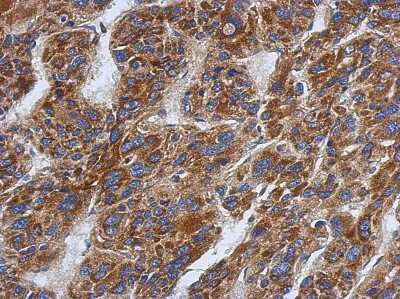 Immunohistochemistry-Paraffin: SFXN1 Antibody [NBP2-20333]