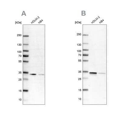Western Blot: SFXN1 Antibody [NBP1-83708]