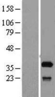 Western Blot: SFXN1 Overexpression Lysate [NBL1-15898]