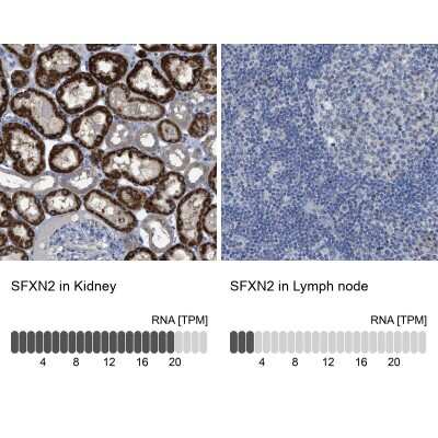 Immunohistochemistry-Paraffin: SFXN2 Antibody [NBP1-86049]