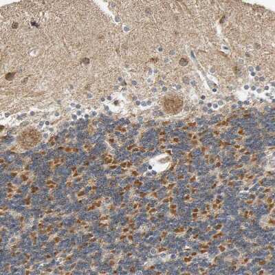Immunohistochemistry-Paraffin: SFXN3 Antibody [NBP1-87047]