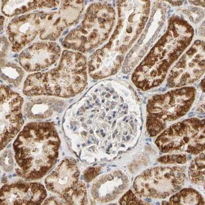 Immunohistochemistry-Paraffin: SFXN3 Antibody [NBP1-87047]