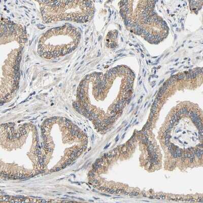 Immunohistochemistry-Paraffin: SFXN3 Antibody [NBP1-87047]