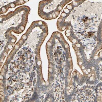 Immunohistochemistry-Paraffin: SFXN3 Antibody [NBP1-87047]