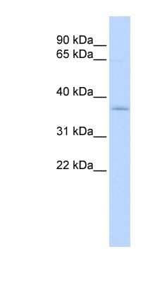 Western Blot: SFXN3 Antibody [NBP1-59728]