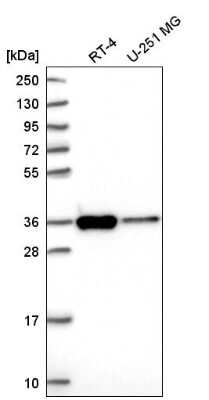 Western Blot: SFXN3 Antibody [NBP2-56306]