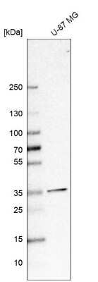Western Blot: SFXN3 Antibody [NBP2-56306]