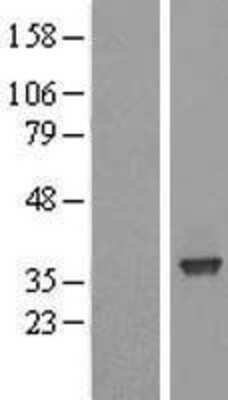 Western Blot: SFXN3 Overexpression Lysate [NBL1-15900]