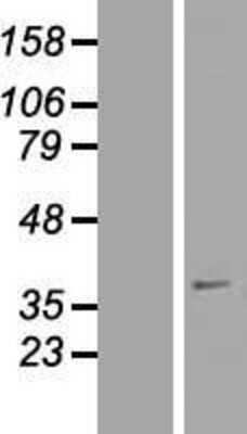 Western Blot: SFXN4 Overexpression Lysate [NBL1-15901]