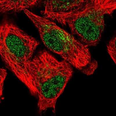 Immunocytochemistry/ Immunofluorescence: SFXN5 Antibody [NBP2-58709]