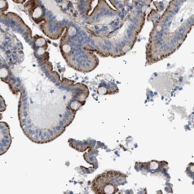 Immunohistochemistry: SFXN5 Antibody [NBP1-88696]