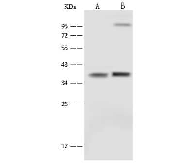 Western Blot: SFXN5 Antibody [NBP2-99580]