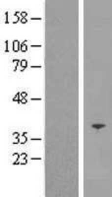 Western Blot: SFXN5 Overexpression Lysate [NBP2-05562]