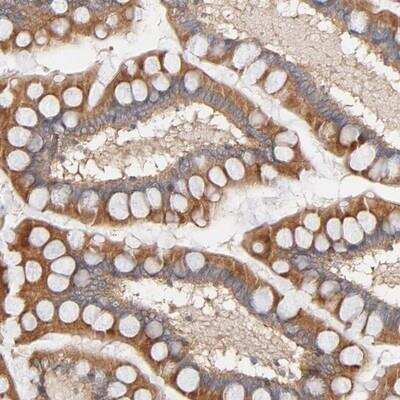 Immunohistochemistry-Paraffin: SG2NA Antibody [NBP1-80763]