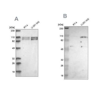 Western Blot: SG2NA Antibody [NBP1-80764]