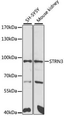 Western Blot: SG2NA AntibodyBSA Free [NBP2-94911]