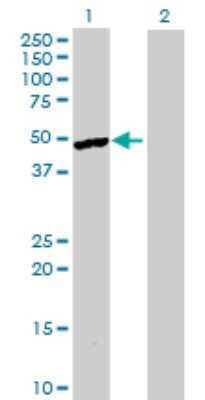 Western Blot: epsilon-Sarcoglycan Antibody [H00008910-B01P]