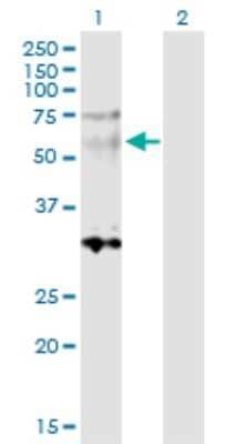 Western Blot: epsilon-Sarcoglycan Antibody [H00008910-D01P]