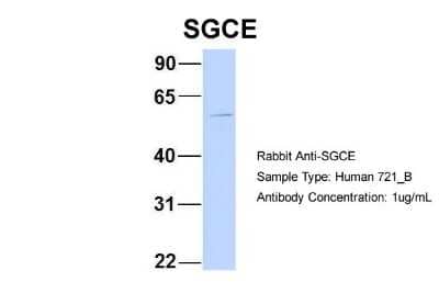 Western Blot: epsilon-Sarcoglycan Antibody [NBP1-59794]