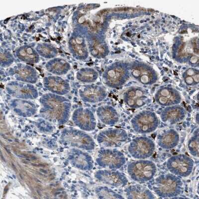 Immunohistochemistry-Paraffin: SGCZ Antibody [NBP2-48536]