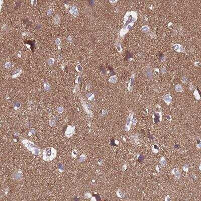 Immunohistochemistry-Paraffin: SGIP1 Antibody [NBP1-92383]