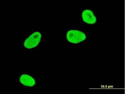 Immunocytochemistry/ Immunofluorescence: SGK1 Antibody (3C4) [H00006446-M04]