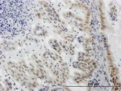 Immunohistochemistry-Paraffin: SGK1 Antibody (3C4) [H00006446-M04]