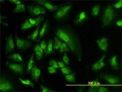 Immunocytochemistry/ Immunofluorescence: SGK1 Antibody (4D7-G3) [H00006446-M01]