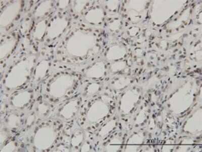 Immunohistochemistry-Paraffin: SGK1 Antibody (4D7-G3) [H00006446-M01]