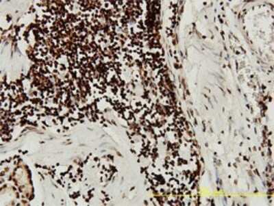 Immunohistochemistry-Paraffin: SGK1 Antibody (4D7-G3) [H00006446-M01]