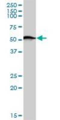 Western Blot: SGK1 Antibody (4D7-G3) [H00006446-M01]