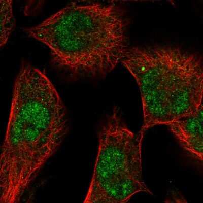 Immunocytochemistry/ Immunofluorescence: SGK1 Antibody [NBP2-56236]