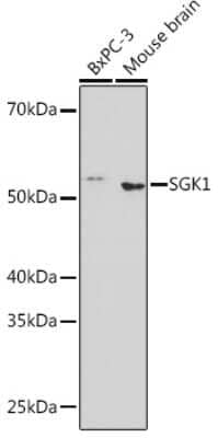 Western Blot: SGK1 Antibody (3P4N3) [NBP3-16296]