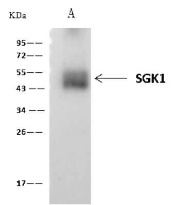 Immunoprecipitation: SGK1 Antibody [NBP2-98778]