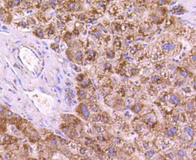 Immunohistochemistry-Paraffin: SGK1 Antibody (SC05-71) [NBP2-67561]