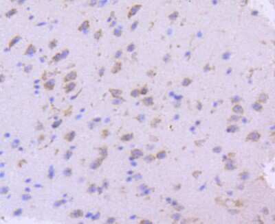 Immunohistochemistry-Paraffin: SGK1 Antibody (SC05-71) [NBP2-67561]