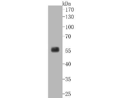 Western Blot: SGK1 Antibody (SC05-71) [NBP2-67561]