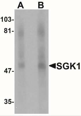 Western Blot: SGK1 AntibodyBSA Free [NBP1-76578]