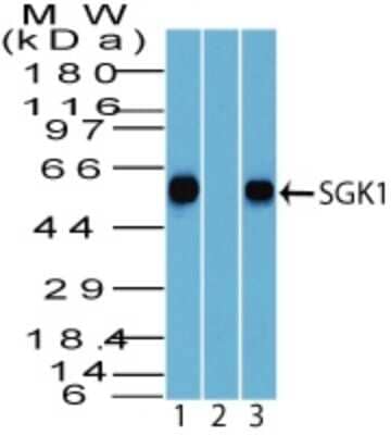 Western Blot: SGK1 Antibody [NBP2-19010]