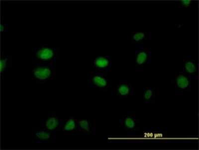 Immunocytochemistry/ Immunofluorescence: SGK2 Antibody (2F6) [H00010110-M07]